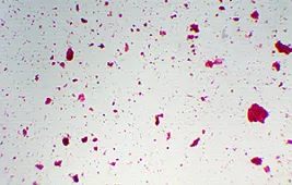 Как выглядят дрожжи под микроскопом